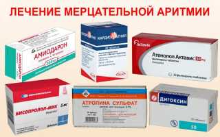 Чем лечить аритмию сердца: лучшие средства