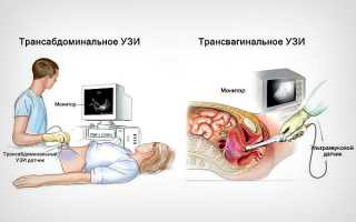Ультразвуковое исследование во время беременности: все, что нужно знать