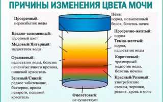Как правильно собрать мочу на общий анализ у взрослых и ребенка