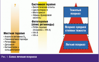 Исследуемые подходы к лечению псориаза – применение новых техник и технологий