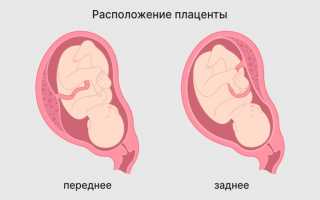Особенности и возможные проблемы плаценты, расположенной по передней стенке матки, с учетом шевелений.