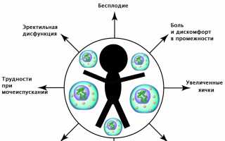 Симптомы, причины, диагностика и лечение уреаплазмы в крови