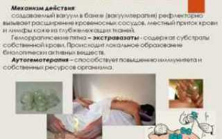 Как правильно ставить банки на больные коленки