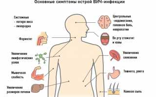 Прыщи при ВИЧ – симптомы, причины и эффективные методы лечения