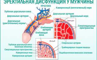 Причины, симптомы и методы лечения психогенной эректильной дисфункции