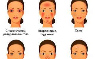 Симптомы, причины и методы лечения аллергии на шпинат