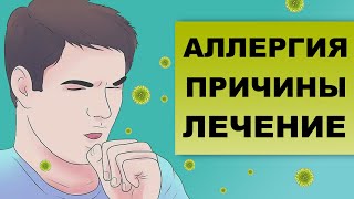 Диагностика и лечение аллергии на аллерген f214 - шпинат IgE