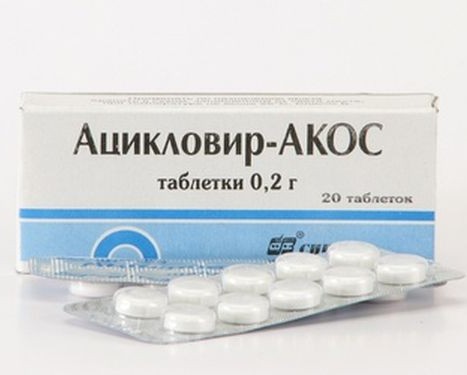 Ацикловир - противовирусный препарат