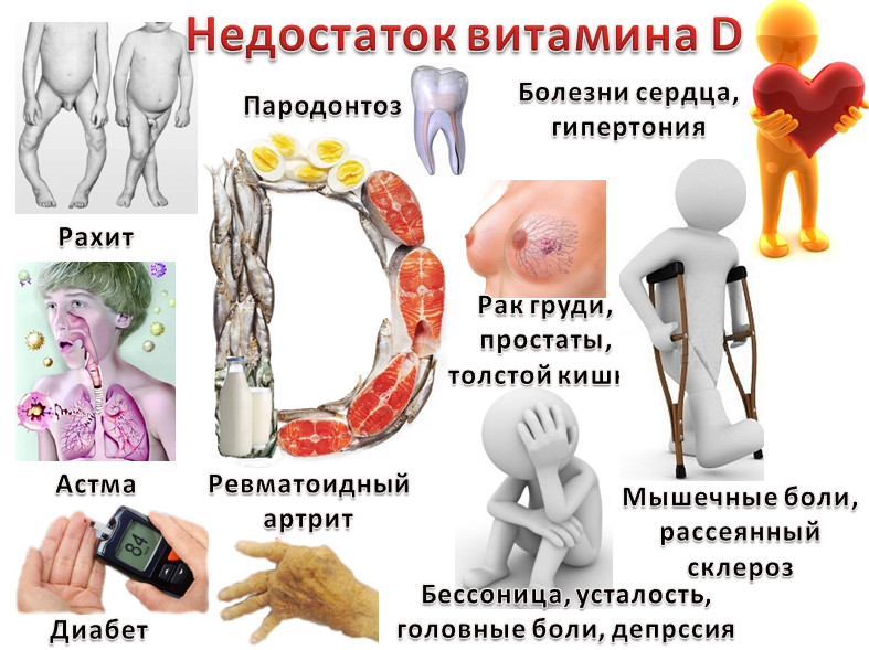 Недостаток витамина D