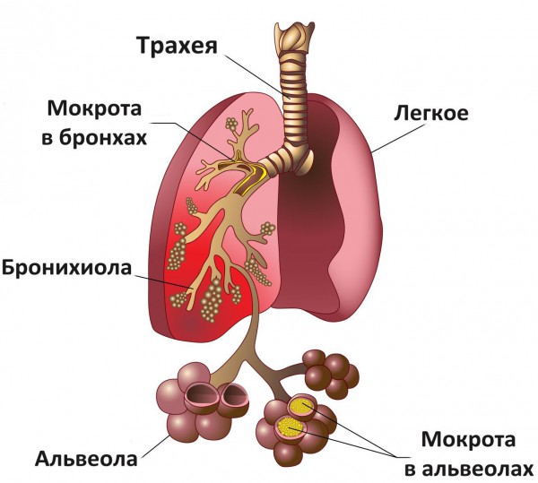 Мокрота при кашле