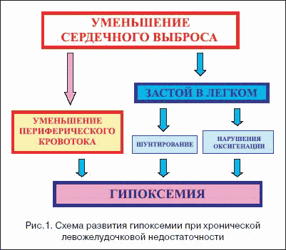 Гипоксемия