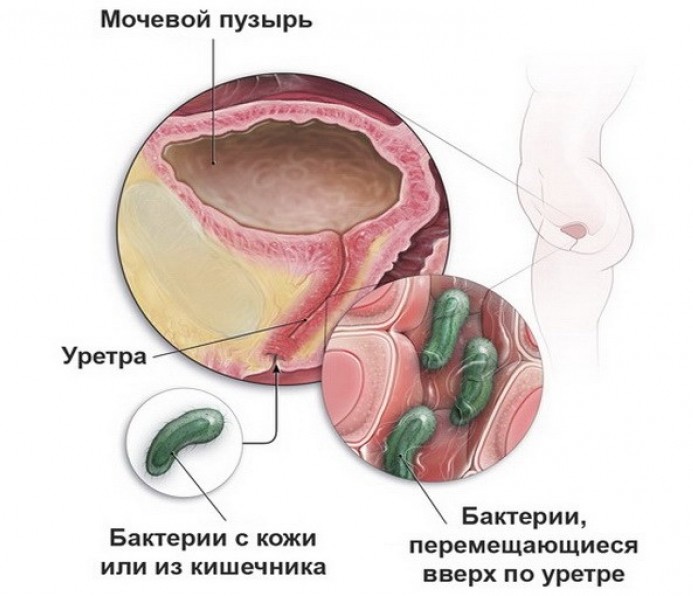 ИМВП