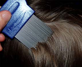 Механический метод от вшей