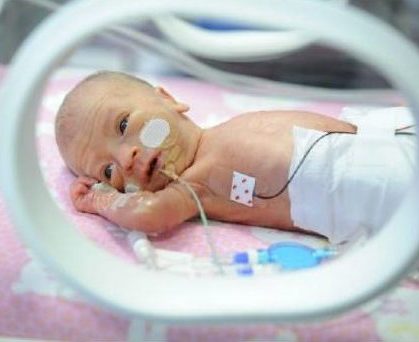 Недоношенный ребенок