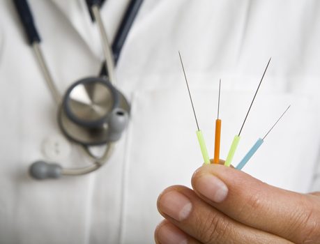 Иглоукалывание
