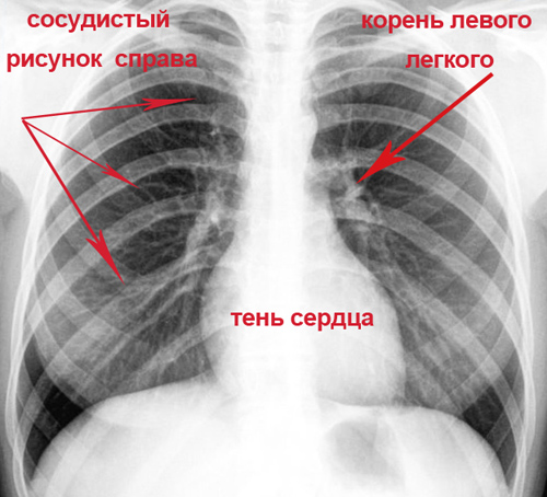 Рентген как метод диагностики болезни
