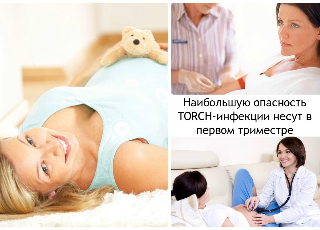 TORCH инфекции как причина патологии
