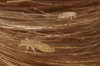 Заражение вшами