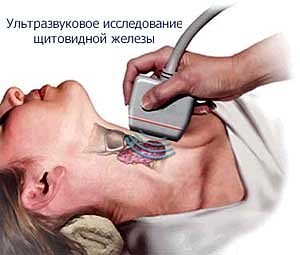 диагностика гипертиреоза
