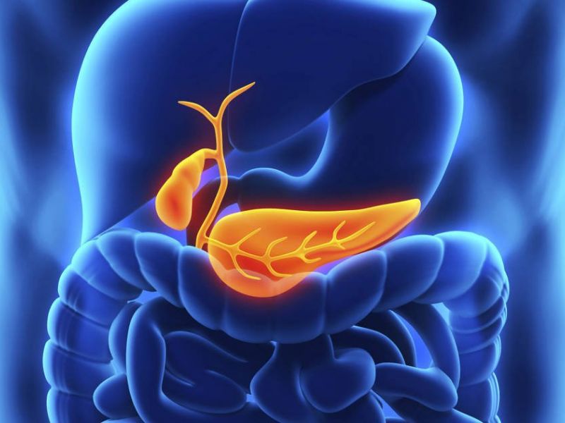 холецистит