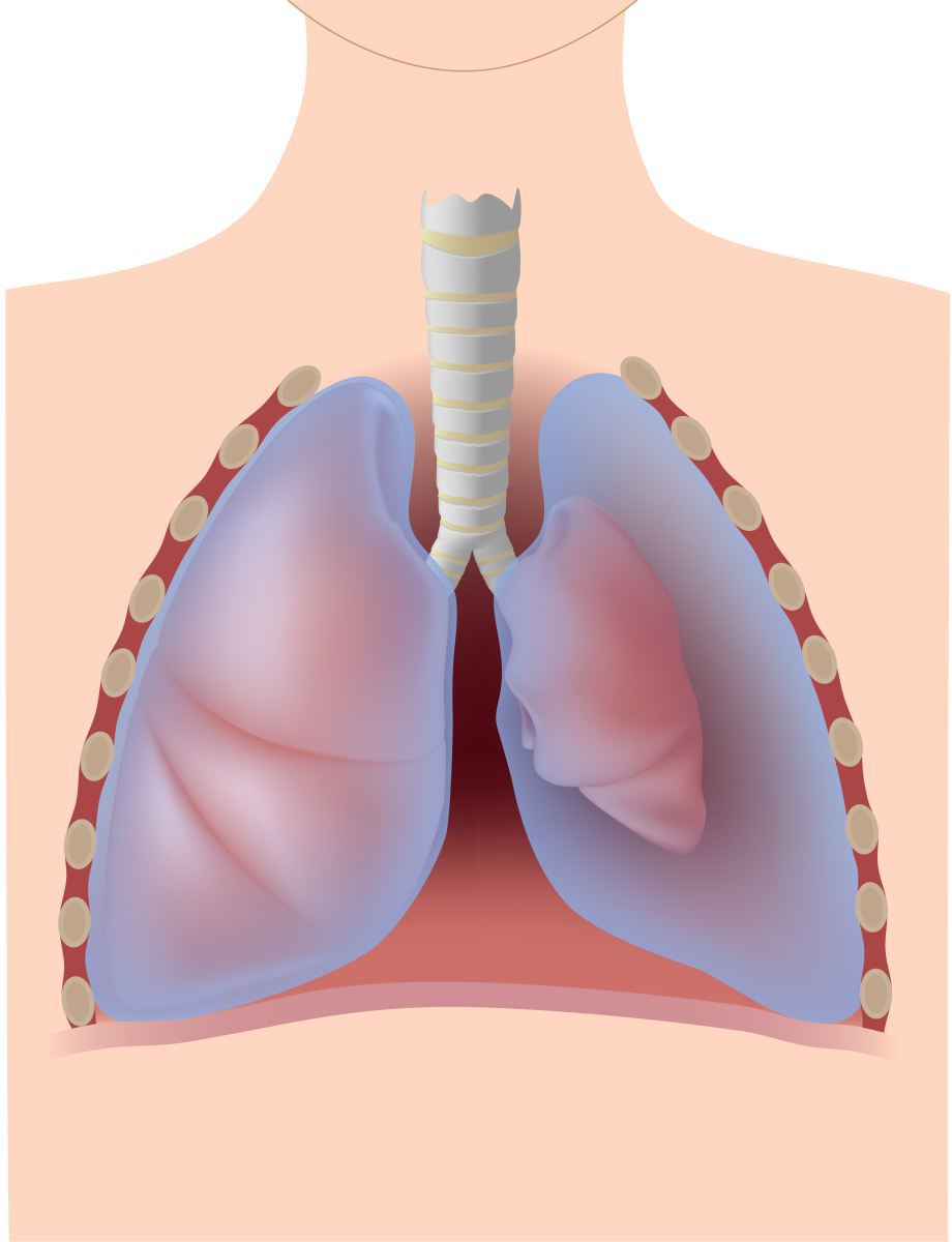 Пневмоторакс