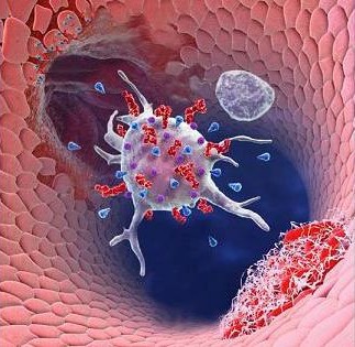 нестенозирующий атеросклероз