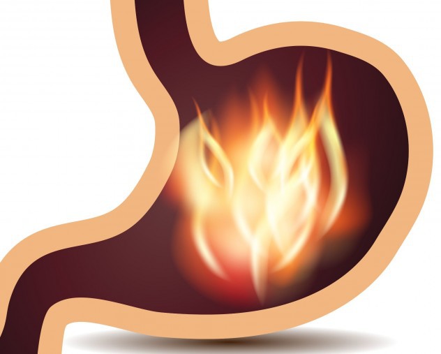 Жжение в желудке