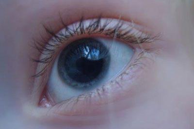 Расширение зрачка