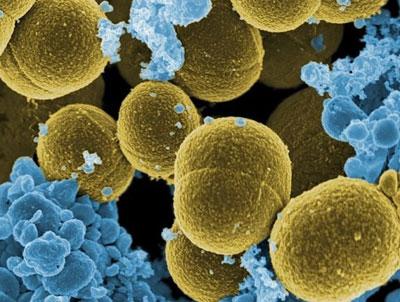 Золотистый стофилоккок под микроскопом