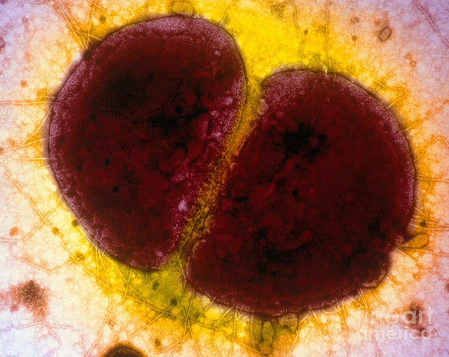 1-neisseria-gonorrhoeae-tem-kwangshin-kim.jpg
