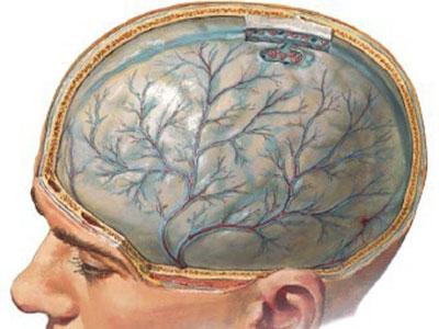 Мозг при токсической энцефалопатии