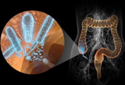 Инфекция в кишечнике