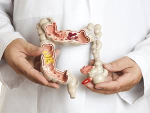 энтероколит