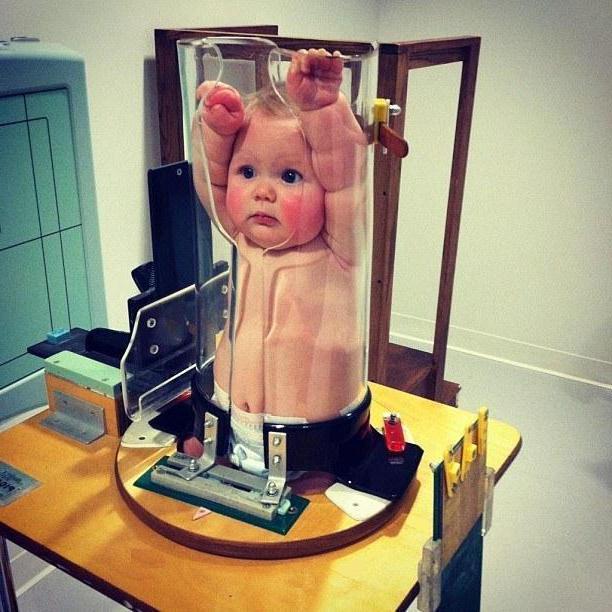 рентген детям