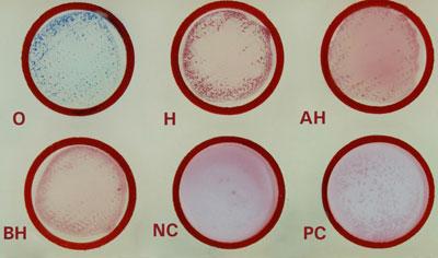 Реакция Видаля