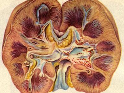 Почечная недостаточность