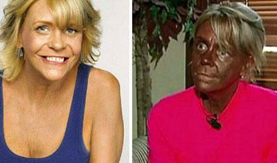 Зависимость от солярия