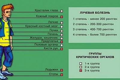 Признаки лучевой болезни