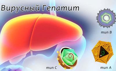 Вирусный гепатит