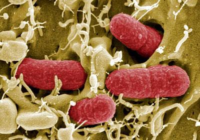 Коли-инфекция под микроскопом