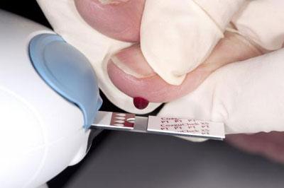 Анализ на МНО