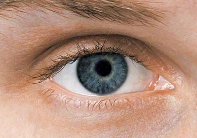 Сужение зрачка