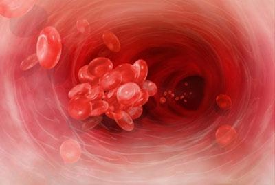 Вязкая кровь