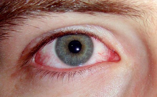 отслоенный глаз