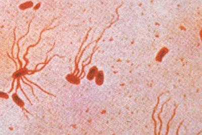 Возбудитель брюшного тифа