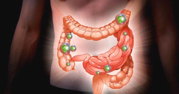 дисбактериоз кишечника.