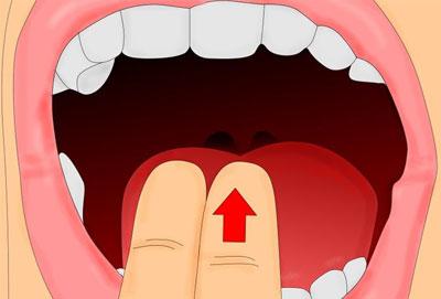 Вызов рвоты