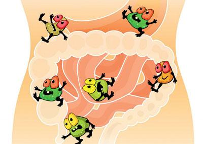 Дисбактериоз кишечника