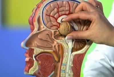 Опухоль гипофиза