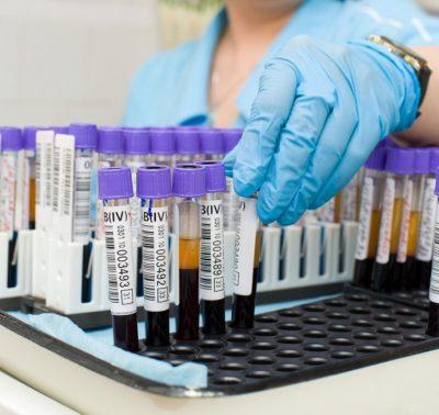 Исследование крови